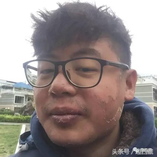 ���һ��Ƥ ���½���ǰ��Ա�ͼ-14.jpg