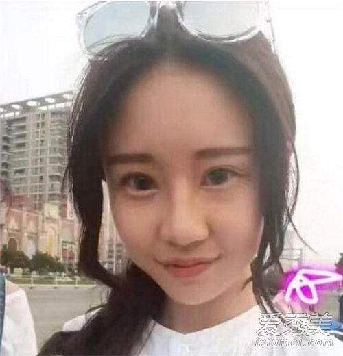 ������������������� ��������ǰ����Ƭ�Ա�-7.jpg