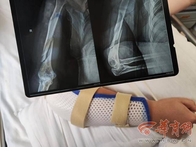 ����ѧ�����������ұ۹��� ����ϣ�����·�����ǰ�渶����-2.jpg