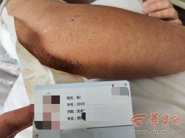 ����ѧ�����������ұ۹��� ����ϣ�����·�����ǰ�渶����-3.jpg